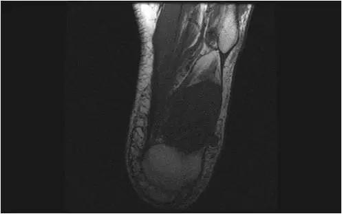 磁共振成像（MRI），揭示软组织细节高清图像揭秘