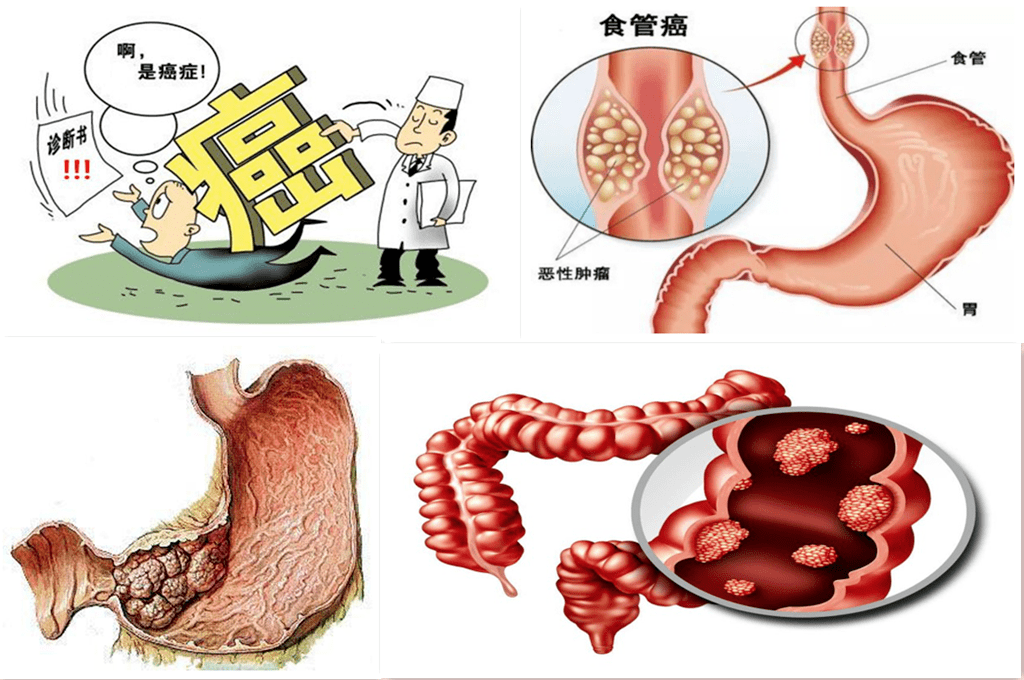 微生物组研究助力消化系统疾病防治新突破