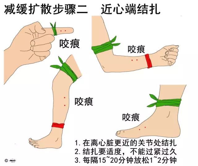 野外蛇咬伤急救指南，处理蛇咬伤的步骤与注意事项