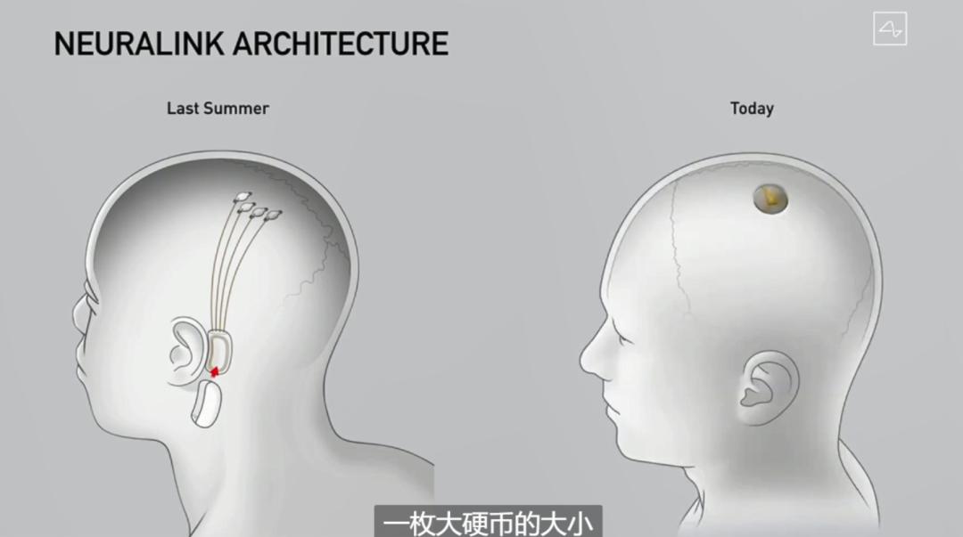 脑机接口技术对人类思维能力的拓展与革新