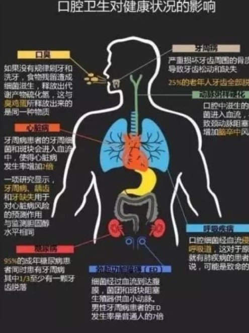 口腔健康对全身健康的长期影响研究概述