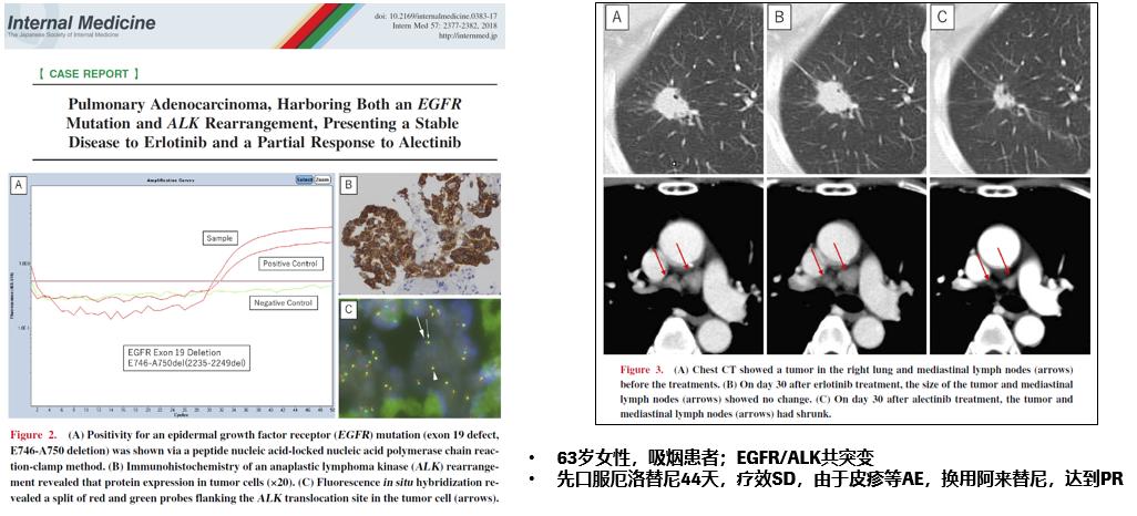 基因突变研究为癌症治疗带来新启示