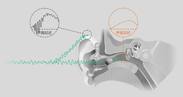 智能助听设备，助力听力受损者更优质交流